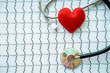 EVMグラフはプロジェクトの健康診断書【プロジェクトマネジメント講座 第14章】